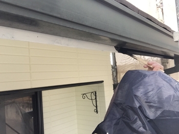 破風　フッ素1回目　M (1).jpeg